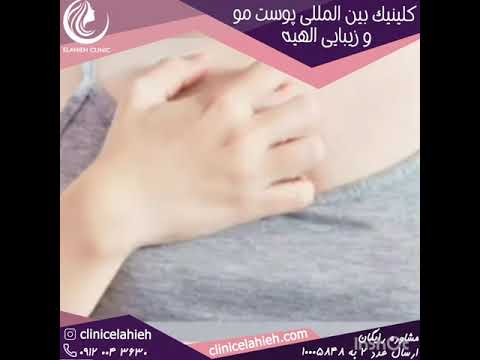همه چیز در خصوص تزریق ژل به سینه مزایا و معایب هزینه ها و ماندگاری