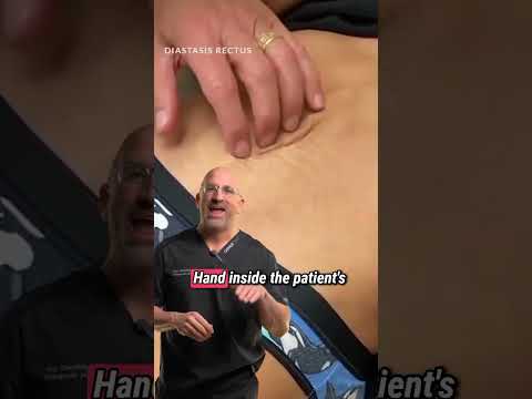 Hand Inside Abdomen Diastasis Recti Shorts