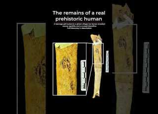 The Ancient Girl Who Died Of Syphilis 700 Years Ago