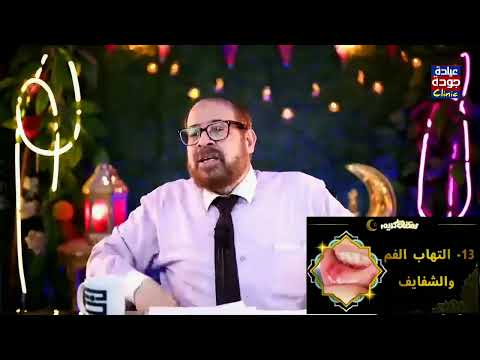 إلتهاب الفم والشفايف دكتور جودة محمد عواد إلتهاب الفم والشفايف دكتور جودة محمد عواد