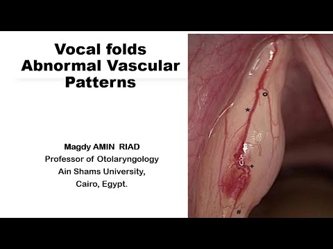 Vocal Folds Abnormal Vascular Patterns