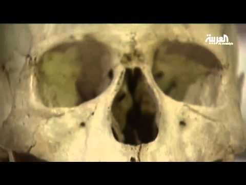 صور تثبت أن دماغ أينشتاين مختلف عن أدمغة الكثيريين