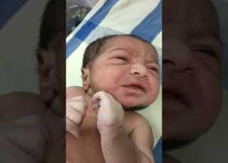  Medical Education Video Neonatology Lip Smacking Movements Subtle Seizures