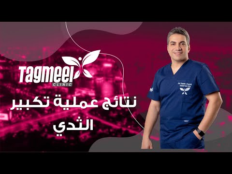 نتائج عملية تكبير الثدي قبل وبعد