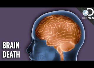 Is A Brain Dead Person Actually Dead