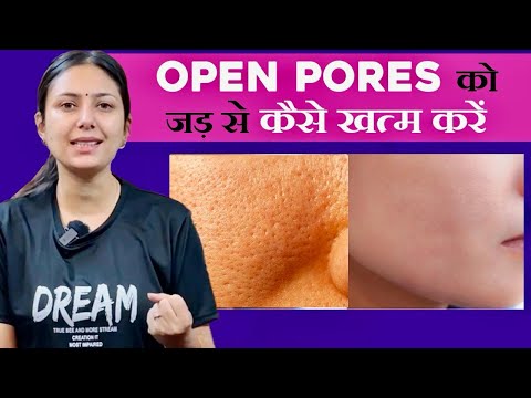 Open Pores क 100 इल ज स र फ 15 द न म Home Remedies For Skin Upasana Ki Duniya Open Pores क 100 इल ज स र फ 15 द न म Home Remedies For Skin Upasana Ki Duniya
