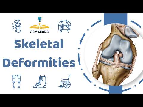 17 Skeletal Deformities Orthopedics Course By Dr Nada Ali