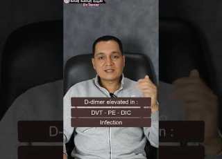  اسباب ارتفاع تحليل دي دايمر بدون جلطات D Dimer طبيب الباطنة العامة