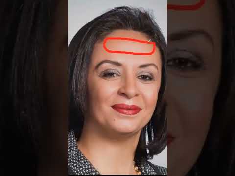 انتفاخ بمنتصف الجبهة علم الفراسة