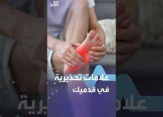  علامات تحذيرية في قدميك