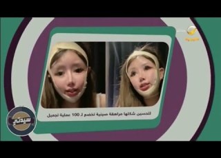  لتحسين شكلها مراهقة صينية تخضع لـ100 عملية تجميل