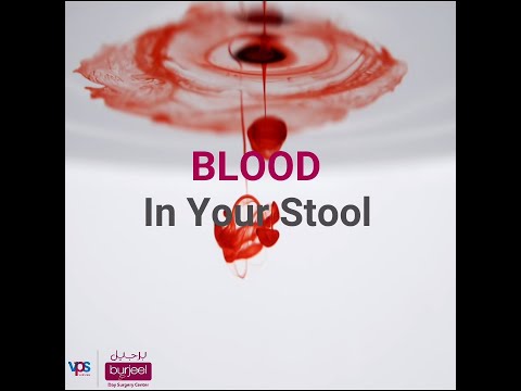 Rectal Bleeding Call 800 55 Burjeel Day Surgery Center Al Reem Island