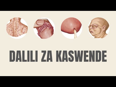 ATTENTIION Dalili Za Kaswende Na Tiba Yake Dalili Kwa Picha ATTENTIION Dalili Za Kaswende Na Tiba Yake Dalili Kwa Picha