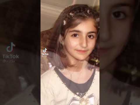 ديمه بشار قبل وبعد