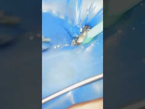 معالجة سطح السن بمادة كاشطة باستخدام أكسيد الألومنيوم 26 ميكرون