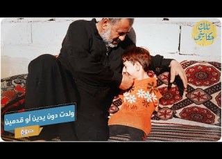 حياة بائسة لطفلة ولدت دون قدمين أو يدين