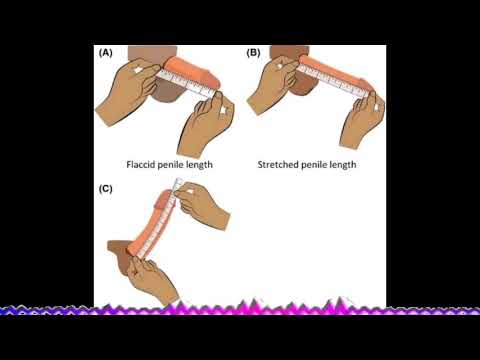 ASIRIN KARFIN AZZAKARI MUJARRABI NE