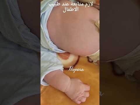 الفرق بين تنفس طبيعي و صعوبة في التنفس عند الرضع