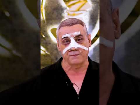 الكل يعرف الفنان استاذ باسل شبيب زوج الفنانه ست اسيا كمال استاذ باسل مسوي زراعةالشعر و تجميل الانف