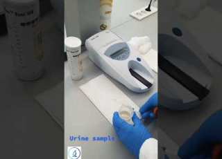Urine Sample Test Done By Step