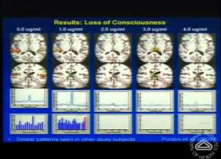  A Look At The Unconscious Brain Under General Anesthesia