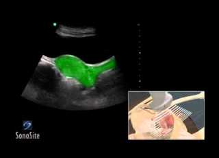  How To Female Pelvis Ultrasound Exam 3D Video