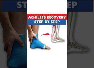  Achilles Tendon Repair Real Recovery Timeline What To Expect
