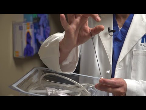 Ablation Procedure Saves Patient S Kidney Ablation Procedure Saves Patient S Kidney