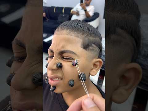 ازالة الحباية المتسلطنة م العين Fyp Foryou Foryoupage Viral Explore Comedy Asmr