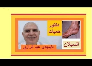  خطورة مرض السيلان