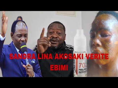 SANDRA LINA AKOSI AZIKI NA MAFUTA VERITE EBIMI APAKOLAKI PEELING VISAGE ETUMBAKA POSO YA ELONGI