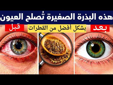 انس الجزر هذه البذرة الصغيرة ت صلح العيون بشكل أفضل من القطرات