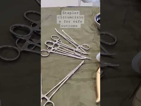Best Circumcision Surgery With Stapler A Day Care Procedure For Safe Outcome Circumcision