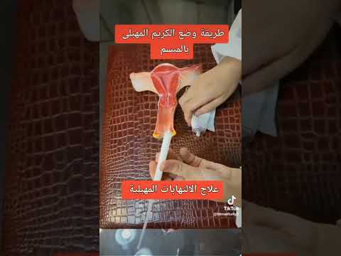 طريقة وضع الكريم المهبلي بالمبسم علاج الالتهابات المهبلية د فاطمة التركي استشاري النساء والولادة طريقة وضع الكريم المهبلي بالمبسم علاج الالتهابات المهبلية د فاطمة التركي استشاري النساء والولادة