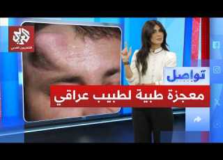 طبيب عراقي ينجح في زراعة أنف في رأس بشري ما القصة تواصل
