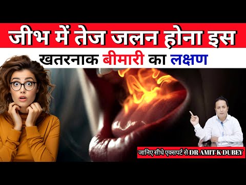 ज भ म त ज जलन Burning Mouth Syndrome Symptoms क य ह बच व Dr Amit K Dubey