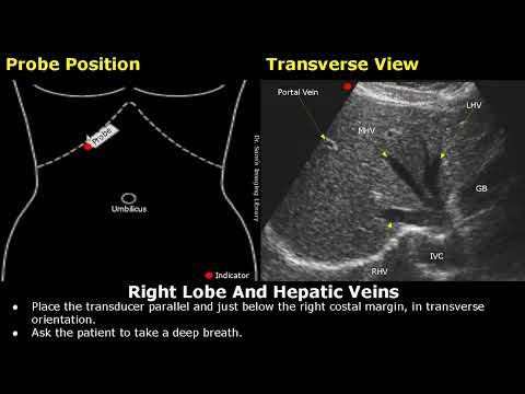 Liver Ultrasound Probe Positioning Transducer Placement For Liver Scanning Abdominal USG Liver Ultrasound Probe Positioning Transducer Placement For Liver Scanning Abdominal USG