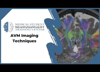 AVM Imaging Techniques
