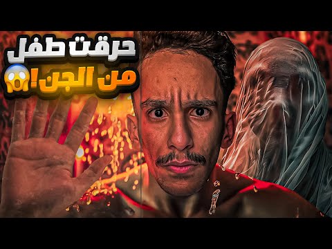 حرقت طفل من الجن قصص فارس