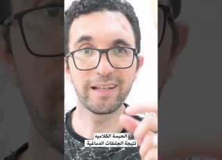  الحبسة الكلاميه نتيجة للجلطات الدماغية