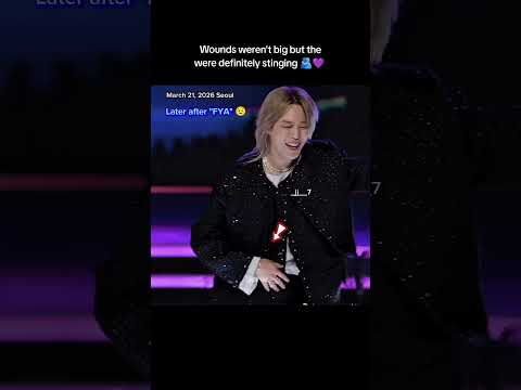 Jimin Realizes He S Injured In The Hand March 21 2026 Seoul Bts