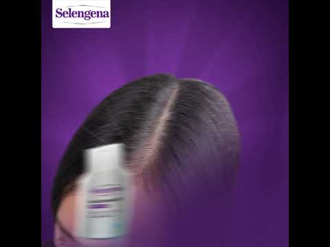 علاج القشرة في 10 أيام