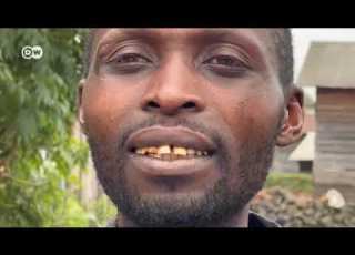  Maji Ya Sake Na Athari Kwa Meno