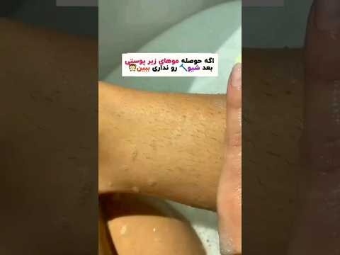 اگه حوصله موهایه زیر پوستی بد شیو رونداری ببین