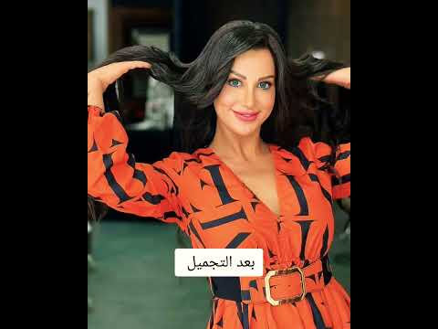 شروق سنشاين زوجة دكتور فود قبل وبعد التجميل شروق