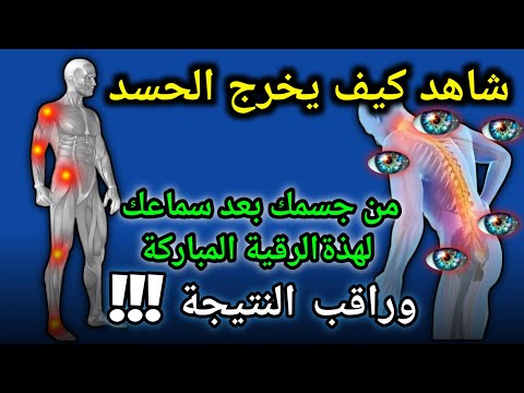بصوت الشيخ علاء عقل الرقية الشرعية لتحقيق الراحة والشفاء Aql
