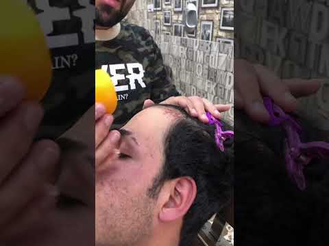 علاج تساقط الشعر وكيفة التخلص من التساقط اشتراك الكوافير احمد باسم علاج تساقط الشعر وكيفة التخلص من التساقط اشتراك الكوافير احمد باسم