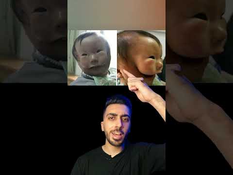 طفل مولود بقناع اغرب اطفال ف العالم 6