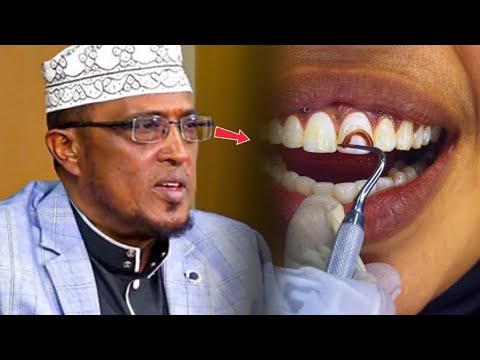 Su Aal Dabarka Ilkaha La Mariyo Salaada Wax Mayeelayaa Sheekh Dirir