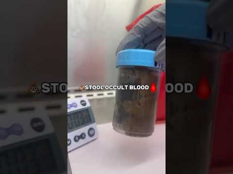 HOW TO STOOL OCCULT BLOOD Mls Laboratorylife Stool Blood